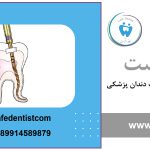 انواع فایل روتاری دندانپزشکی به همراه تصویر 16 فایل روتاری چیست