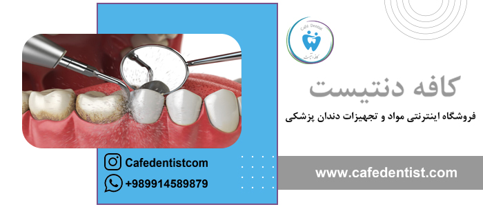انواع پولیش دندان