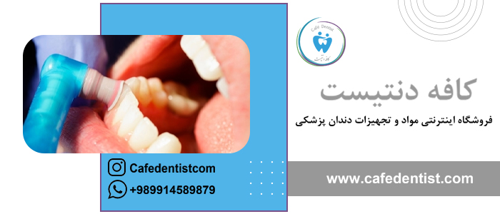 پولیش دندان در خانه