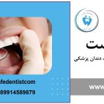 آشنایی با وسایل دندانپزشکی برای دستیار