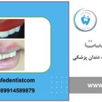 کامپوزیت دندان