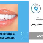 فرق لمینت و کامپوزیت