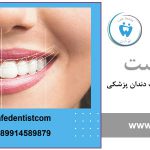 مراحل کامپوزیت دندان