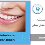 راه های مراقبت بعد از کامپوزیت دندان