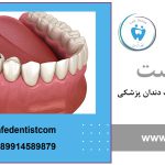 گوتا پرکا در دندانپزشکی چیست ؟