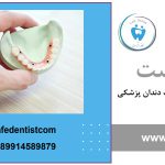 پین در دندانپزشکی چیست؟