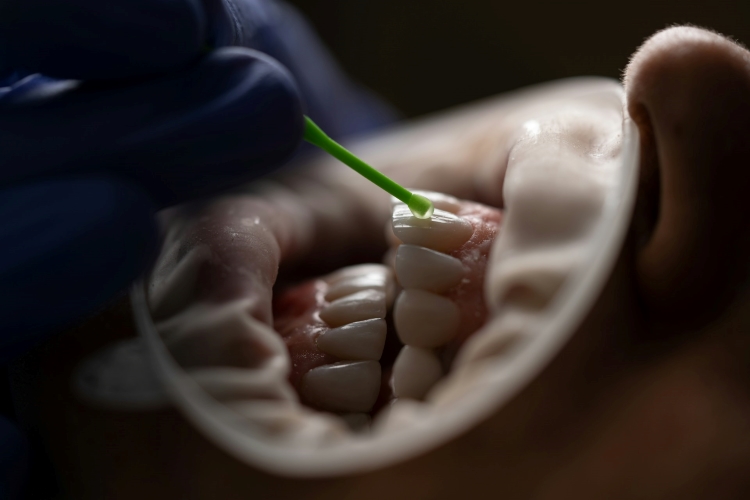 پروتز دندان و دندان مصنوعی