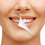 ژل سفید کننده دندان فوری