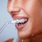 شاخص واترجت دندان چیست؟ 