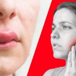 معرفی آلرژی های مربوط به دندانپزشکی