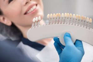 فرق لمینت و کامپوزیت چیست و کدام یک بهتر است؟