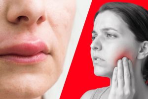 معرفی آلرژی های مربوط به دندانپزشکی
