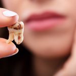 اگر دندان را عصب کشی نکنیم چه میشود؟