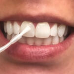 لاک سفید کننده دندان خانگی چیست؟ 8 لاک سفید کننده دندان خانگی چیست؟