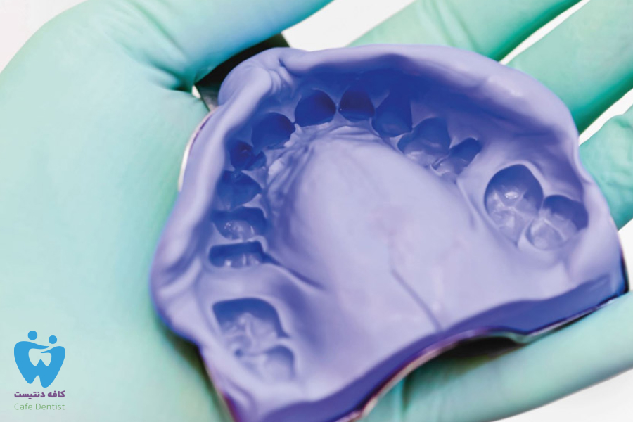 آلژینات دندانپزشکی چیست