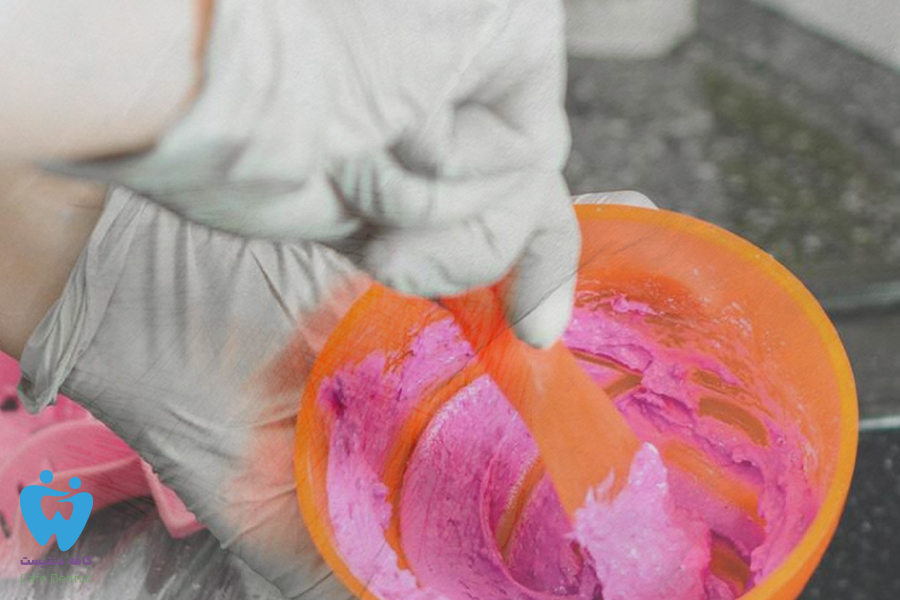 آلژینات دندانپزشکی چیست