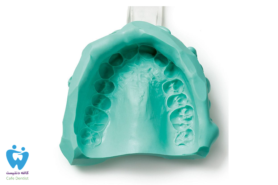 آلژینات دندانپزشکی چیست و چه کاربردی دارد 4 آلژینات دندانپزشکی چیست و چه کاربردی دارد؟