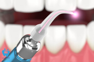 کاربرد لیزر در دندانپزشکی و مزایای آن