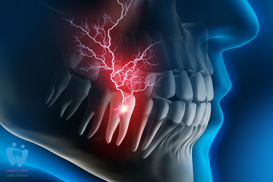 دلایل درد دندان پانسمان شده