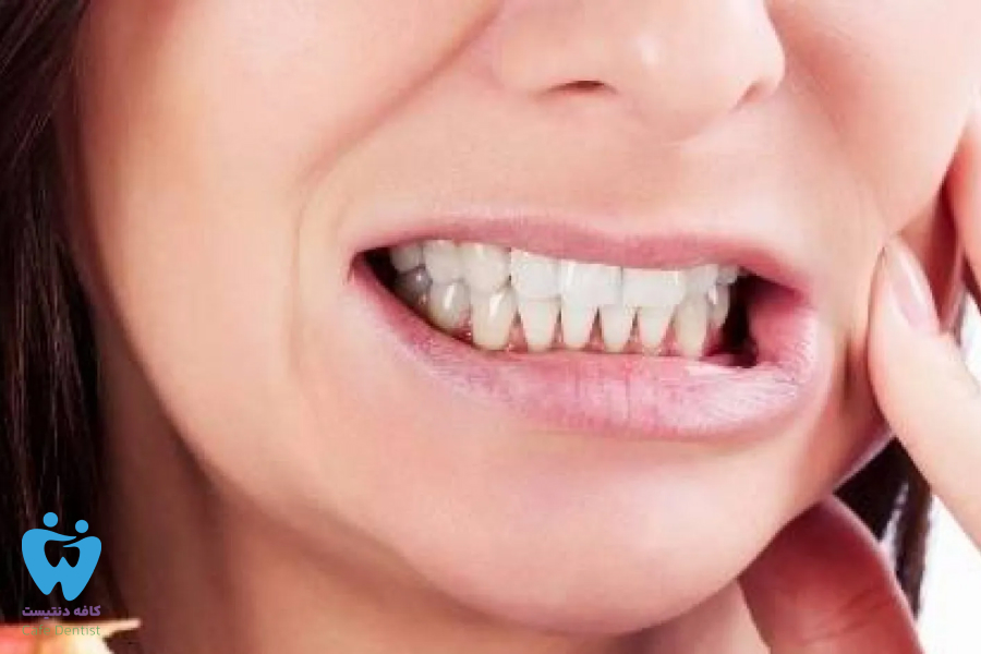 درمان دندان لق شده در بزرگسالی