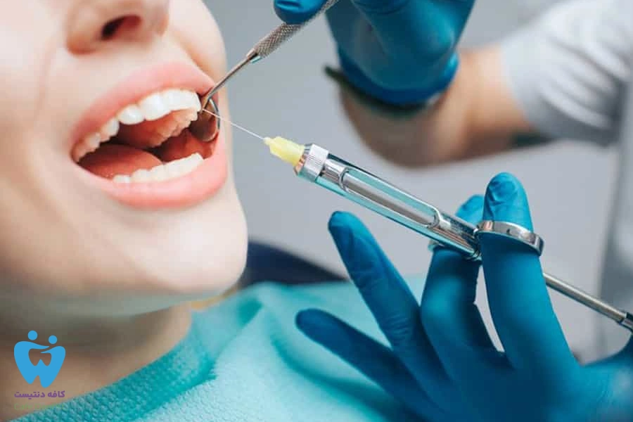کارپول دندانپزشکی چیست؟